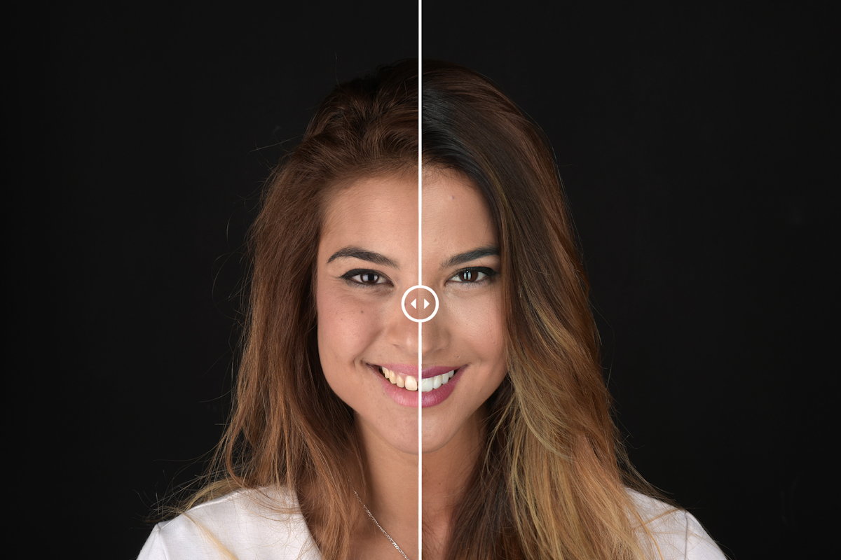 casos clinica dentista madrid
